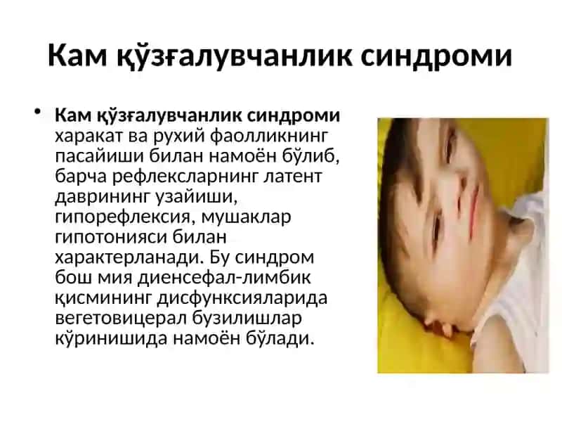 Кам қўзғалувчанлик синдроми 2