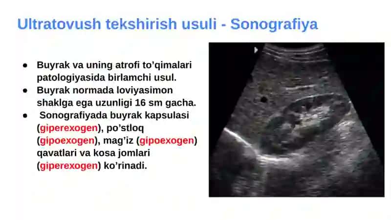 Ultratovush tekshirish usuli - Sоnоgrafiya 2