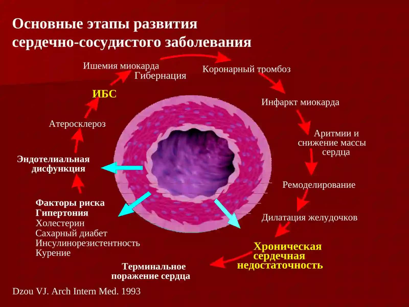 Пульсурежающая терапия у пациентов с ИБС и ХСН 2