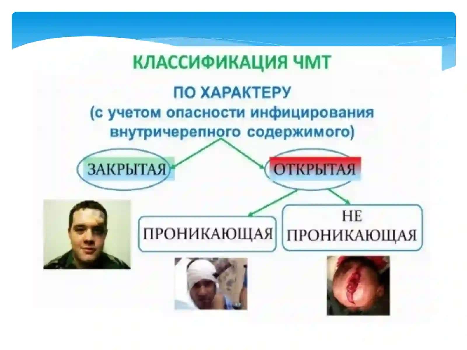 BOSH MIYA TRAVMALARI 2