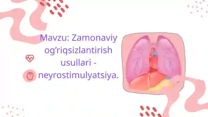 Neurostimulyatsiya 2