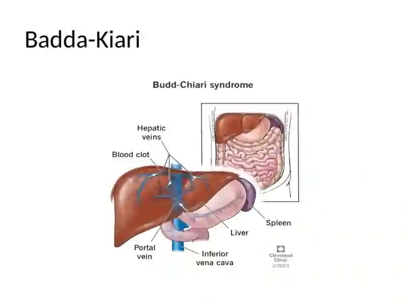 Badda-Kiari 2