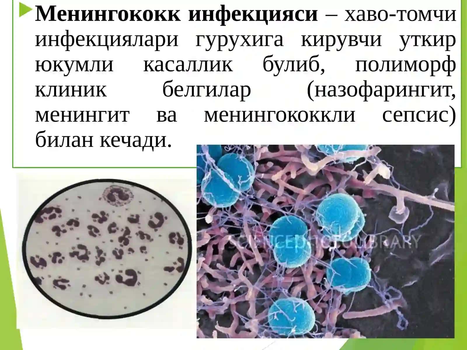 Менингококкли инфекция энцефалит ва полиомиелит патоморфологияси 2