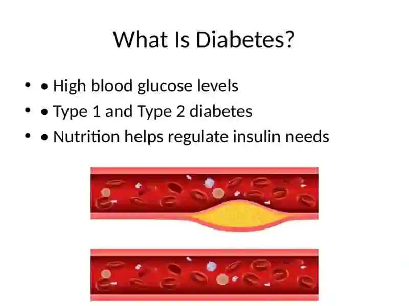 Healthy eating plan for diabetic patients 2