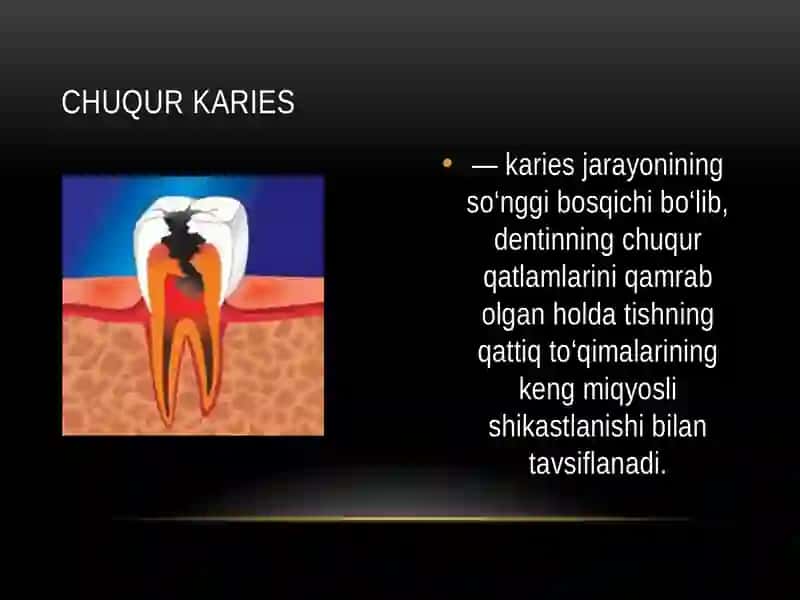 CHUQUR KARIES. O`TKIR VA SURUNKALI SHAKLLARINI KLINIK KECHISHI, TASHXISLASH.

QIYOSIY TASHXISI.FIZIK 2