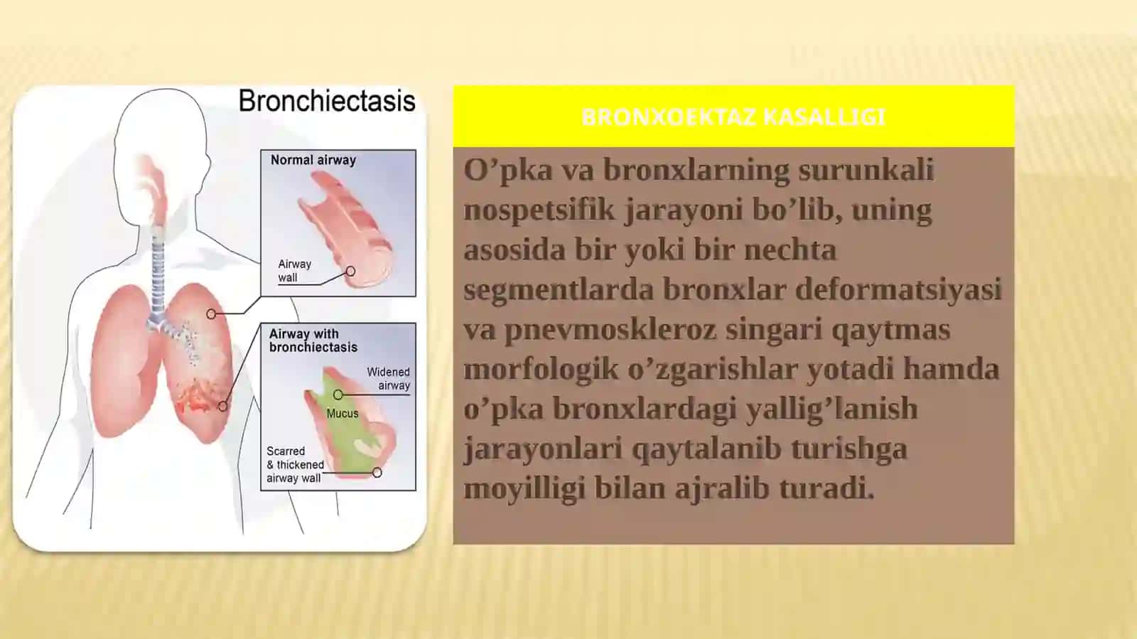 Bronxoektaz kasalligi 2
