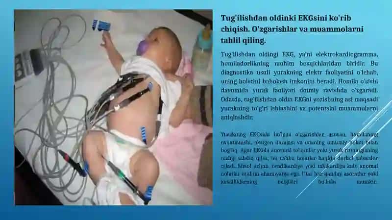 Elektrokardiogramma (EKG) 2