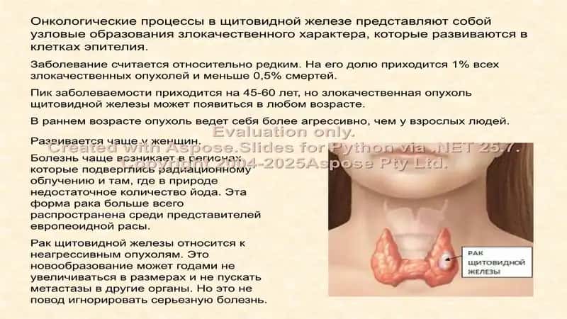 Рак щитовидной железы 2