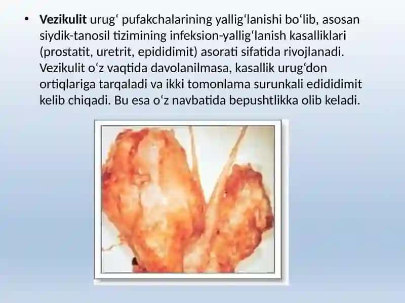 ERKAKLAR TANOSIL A`ZOLARI, AYOLLAR TANOSIL A`ZOLARI 2