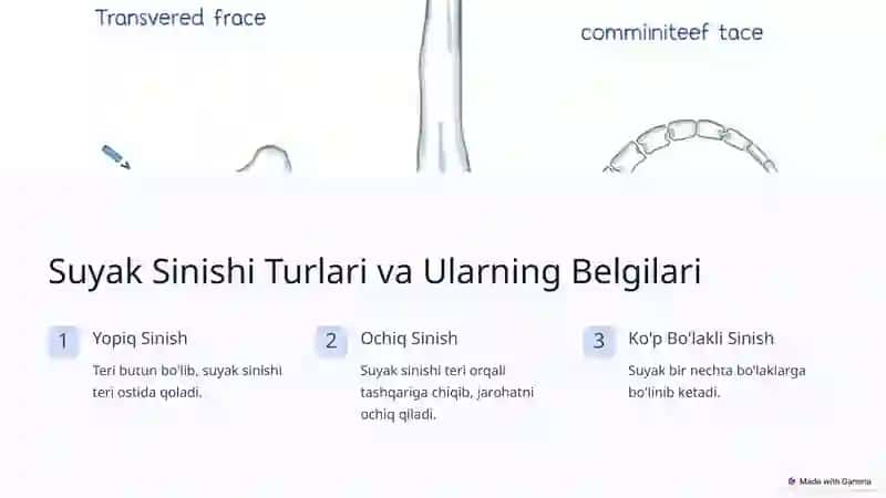 Suyak Sinishida Zamonaviy Davolash Usullari 2