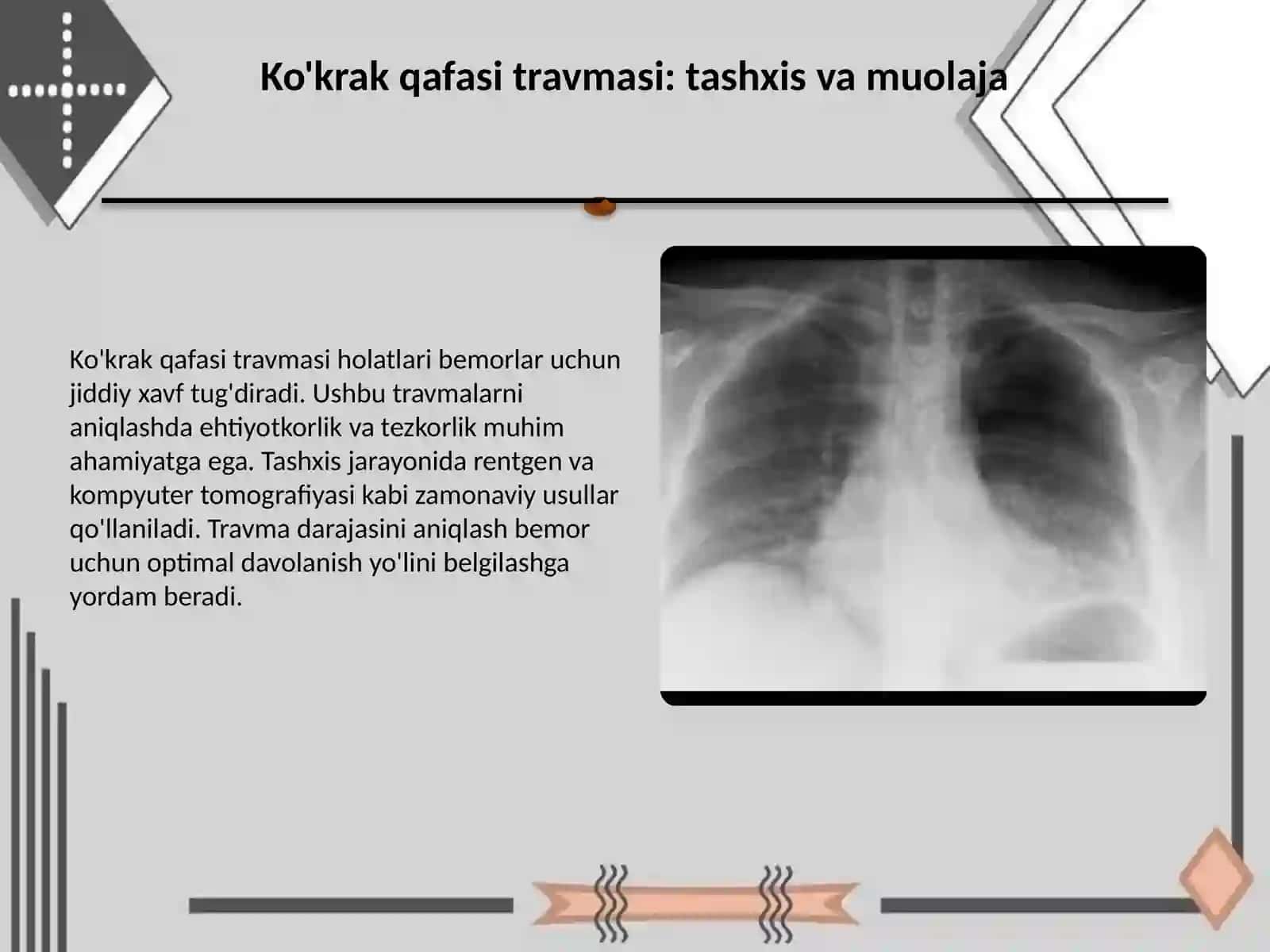 Ko'krak qafasi, qorin boshlig'i kichik tos a'zolari travmasi. Politravmada tekshirish taktikasi 2