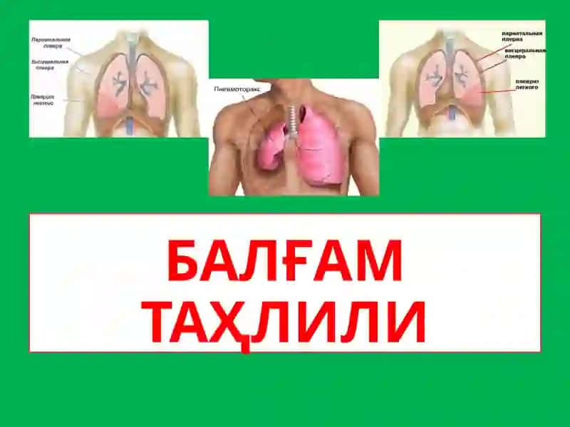 Balg‘am va plevra suyuqligini laborator tekshirish. 2