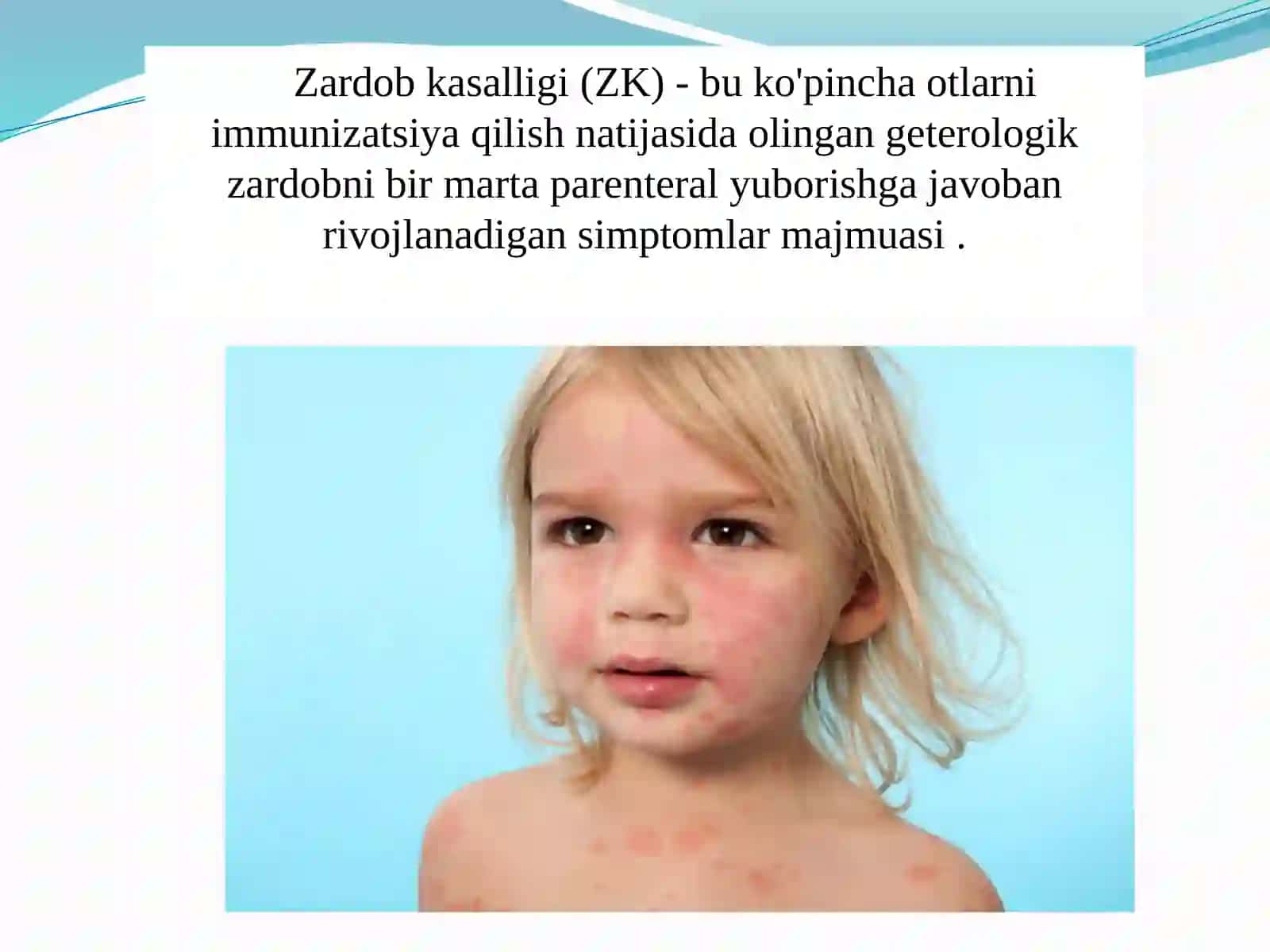 Zardob kasalligi 2