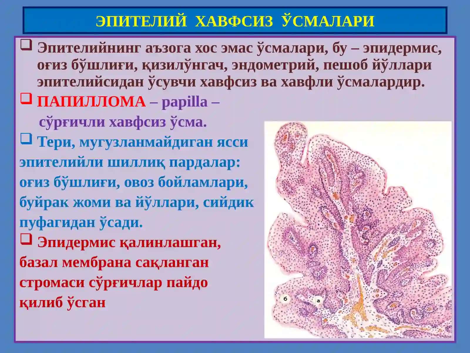 Ўсмалар.Мезенхималўсмалар 2