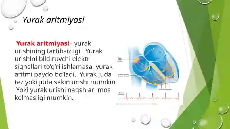 Yurak aritmiyalari EKG diagnostikasi 2