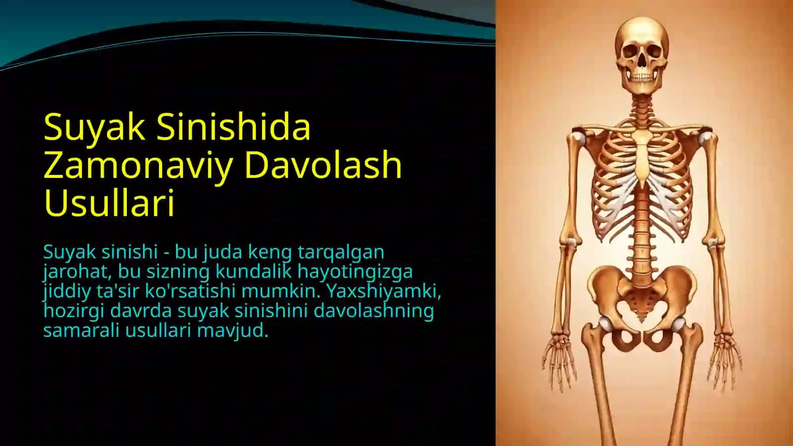 Suyak Sinishida Zamonaviy Davolash Usullari 2