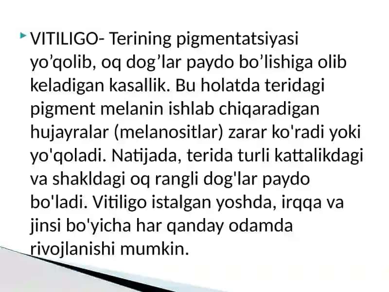 VITILIGONING ZAMONAVIY DAVOLASH USULI 2