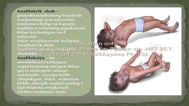 Anafilaktik shok 2