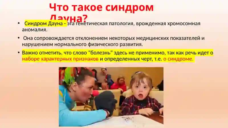 Синдром Дауна 2