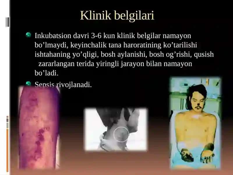YUqumlivayuqumsizkasalliklar 2