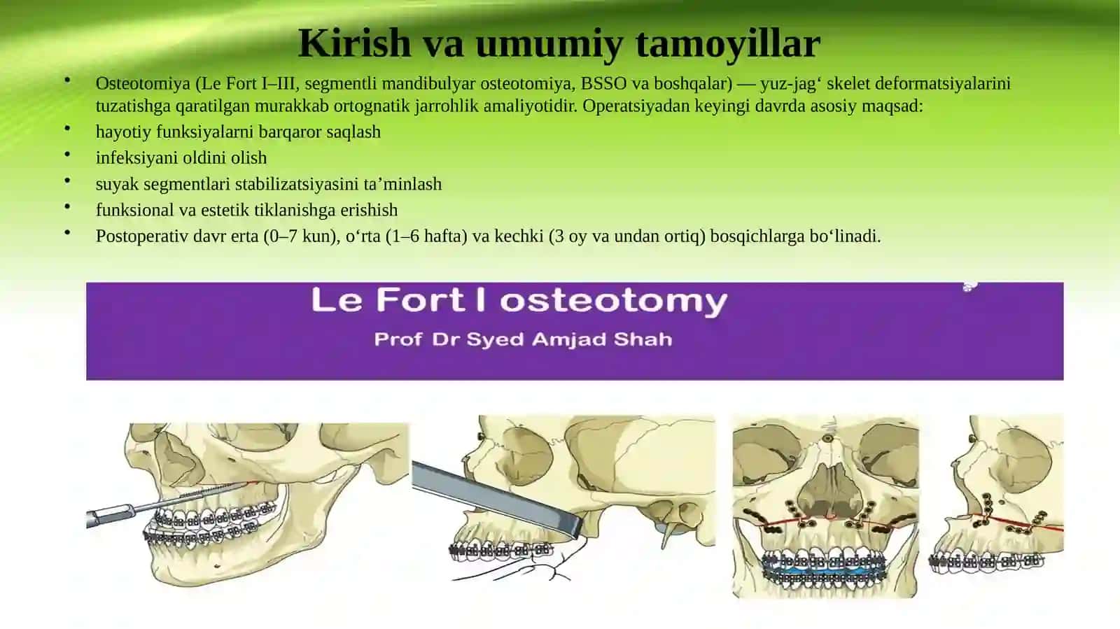 Osteotomiya o‘tkazilgan bemorlarda operatsiyadan so‘ng parvarishlash 2
