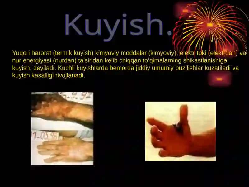 KUYISH DARAJALARI 2