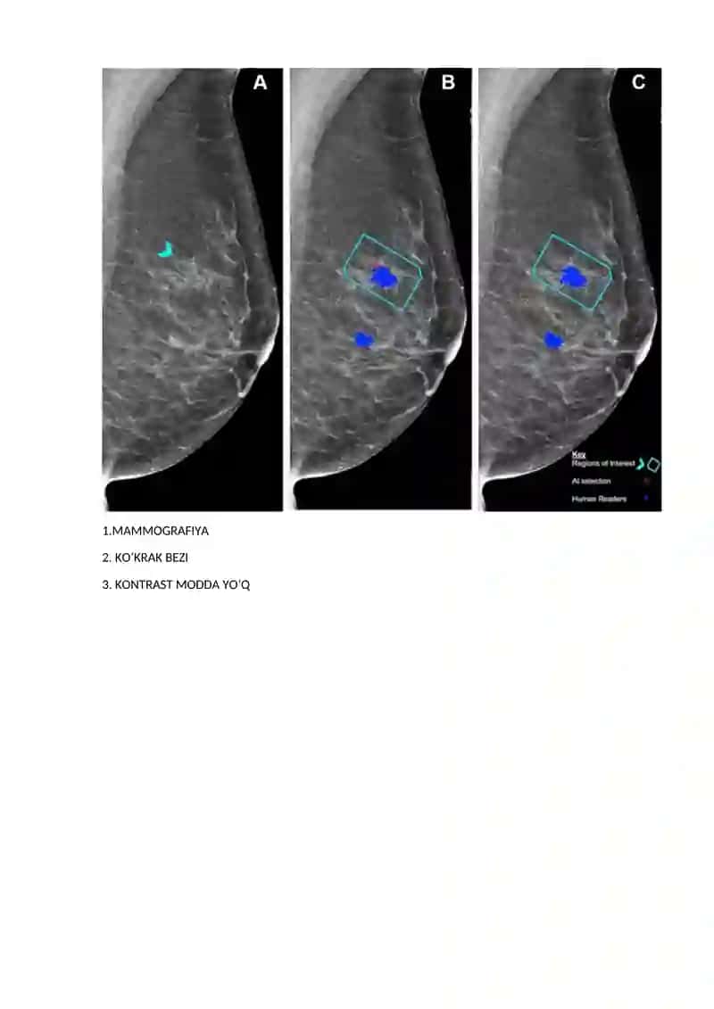 MAMMOGRAFIYA 1-DAV 305B TESHAYEVA DURSANAM 2