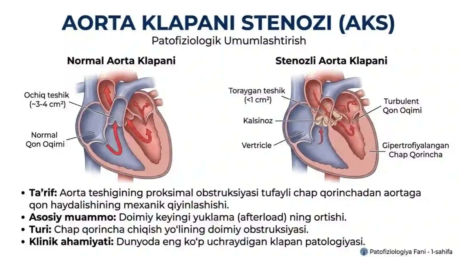 Aorta klapani stenozitaqdimot tibbi 2