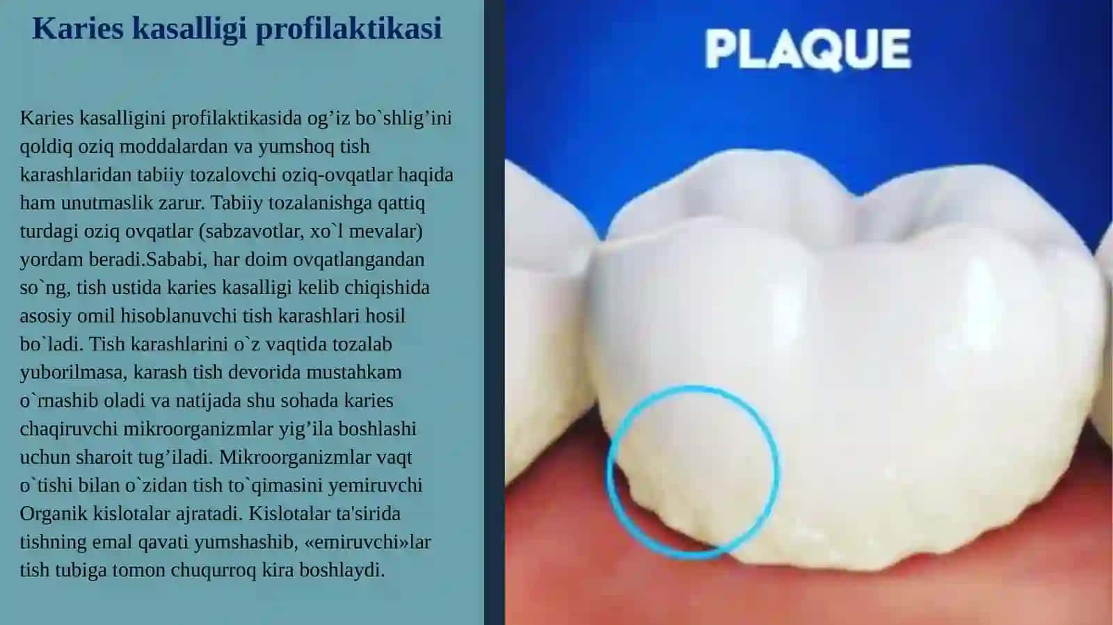 Karies kasalliginiprofilaktikasi 2