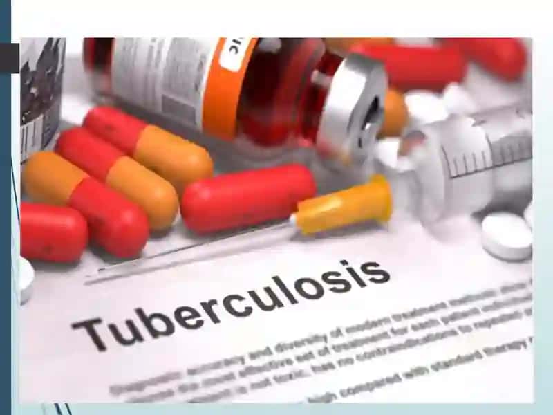 Tuberkulyoz bemorlarini davolash va kuzatish sxemalari 2