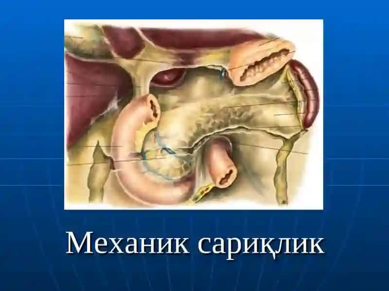 Mexanik sariqlik | Механик сариқлик 2