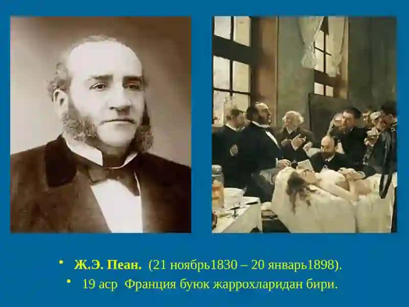 Меъда ва 12 бармокли ичак жаррохлигининг тарихий асослари 2