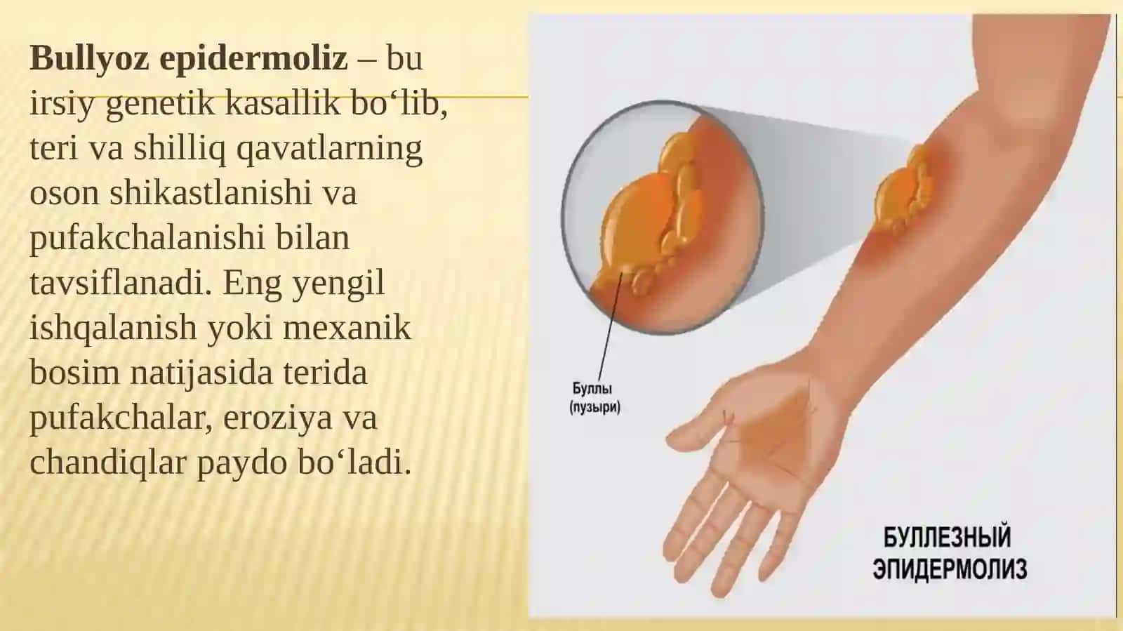 Bullyozepidermoliz.Xeyli-xeylikasalligi.Chuqurmikozlar 2