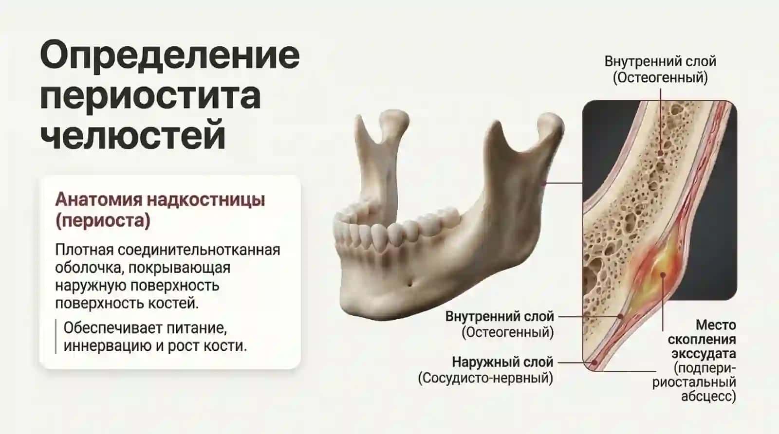 Периостит челюстий 2
