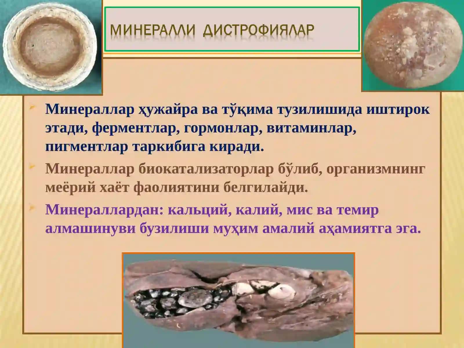 ПАТОЛОГИК АНАТОМИЯ 2