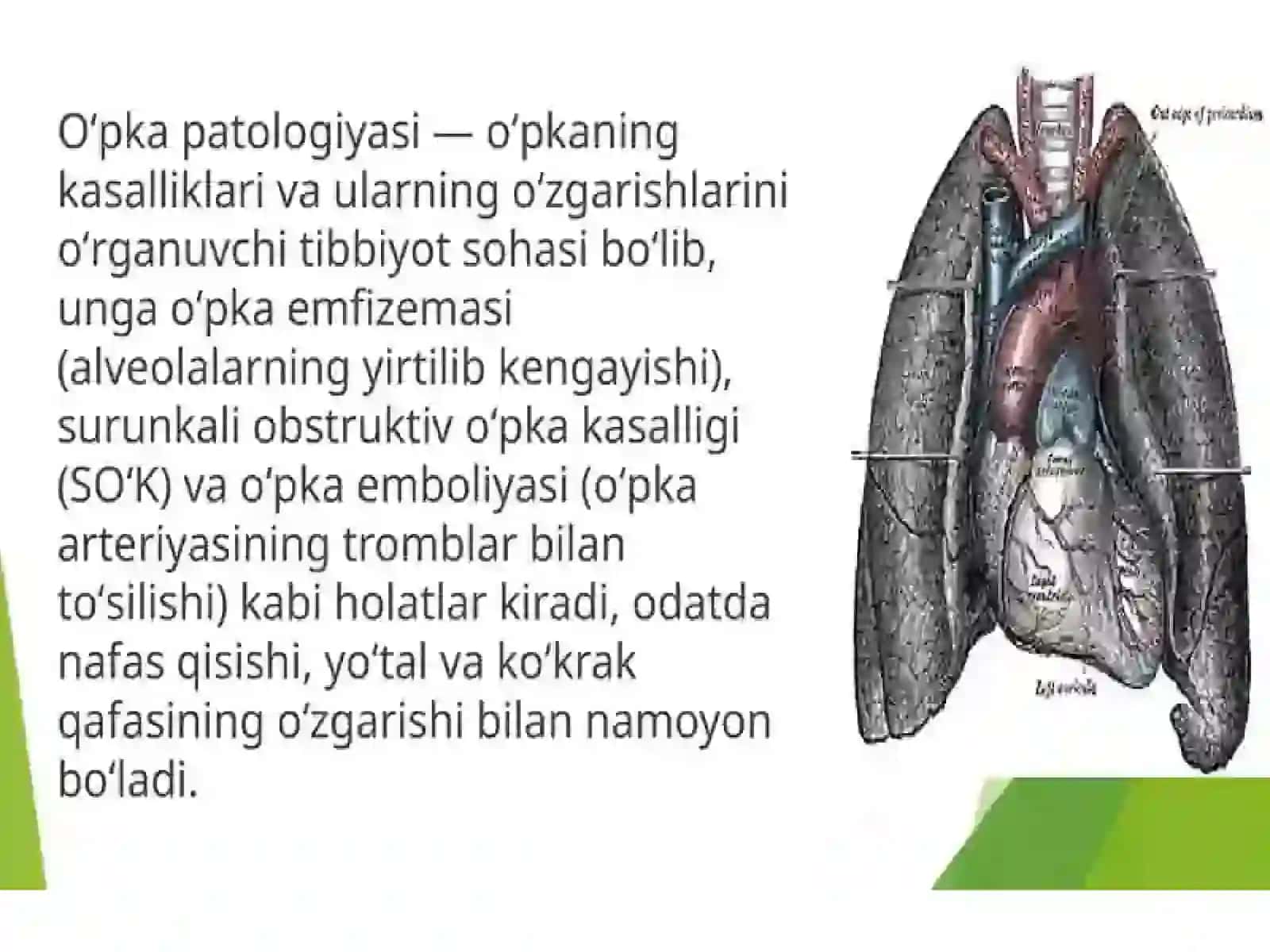 O'pka patologiyasi. Tug'ma anomaliyalar. O'tkir respirator sindromi. 2