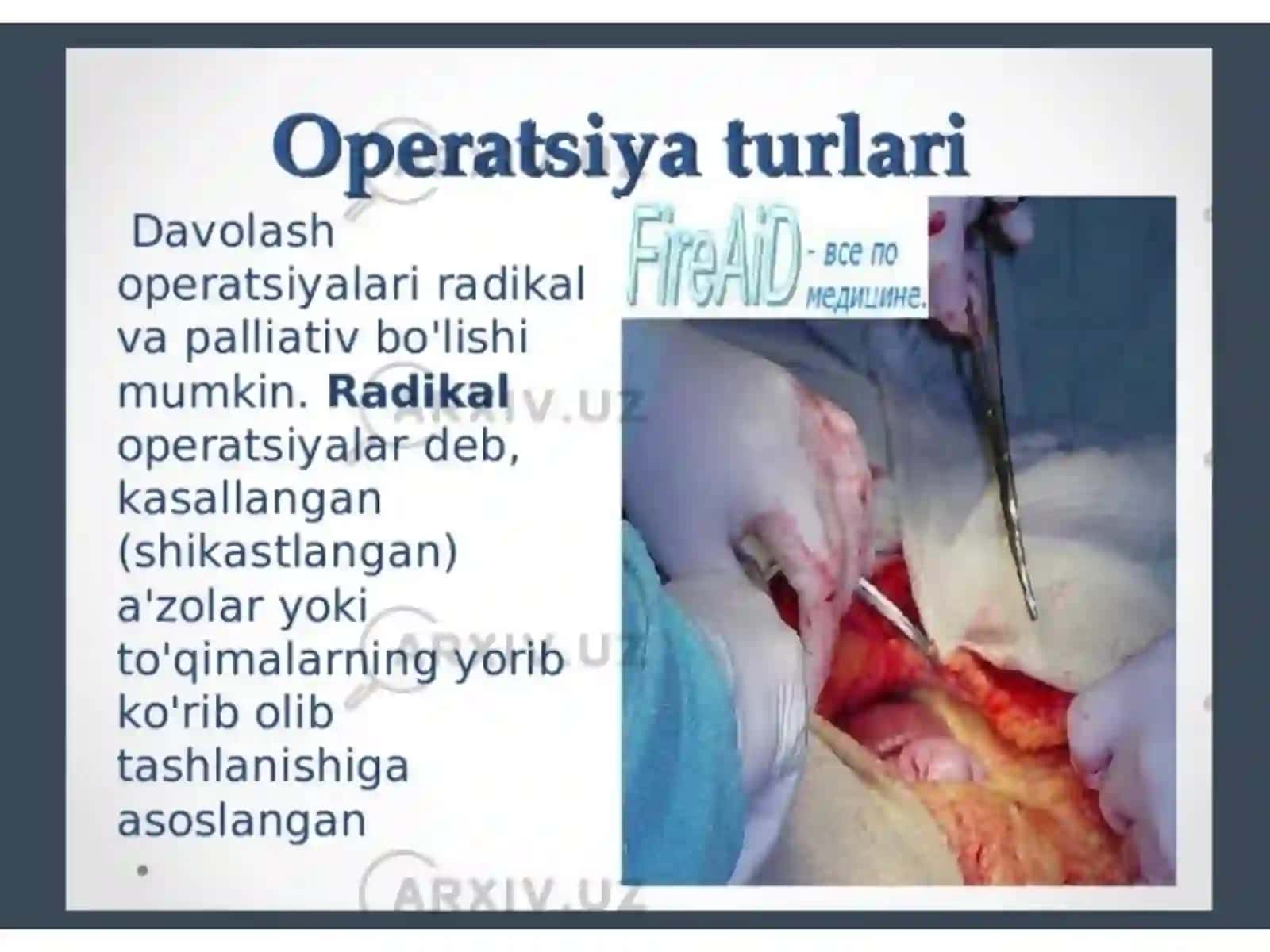 Operatsiya turlari. Operatsiyadan keyin va oldingi davr 2