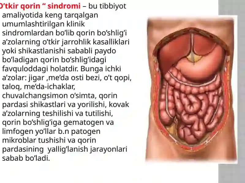 “O’TKIR QORINmuammosi” SINDROMI 2