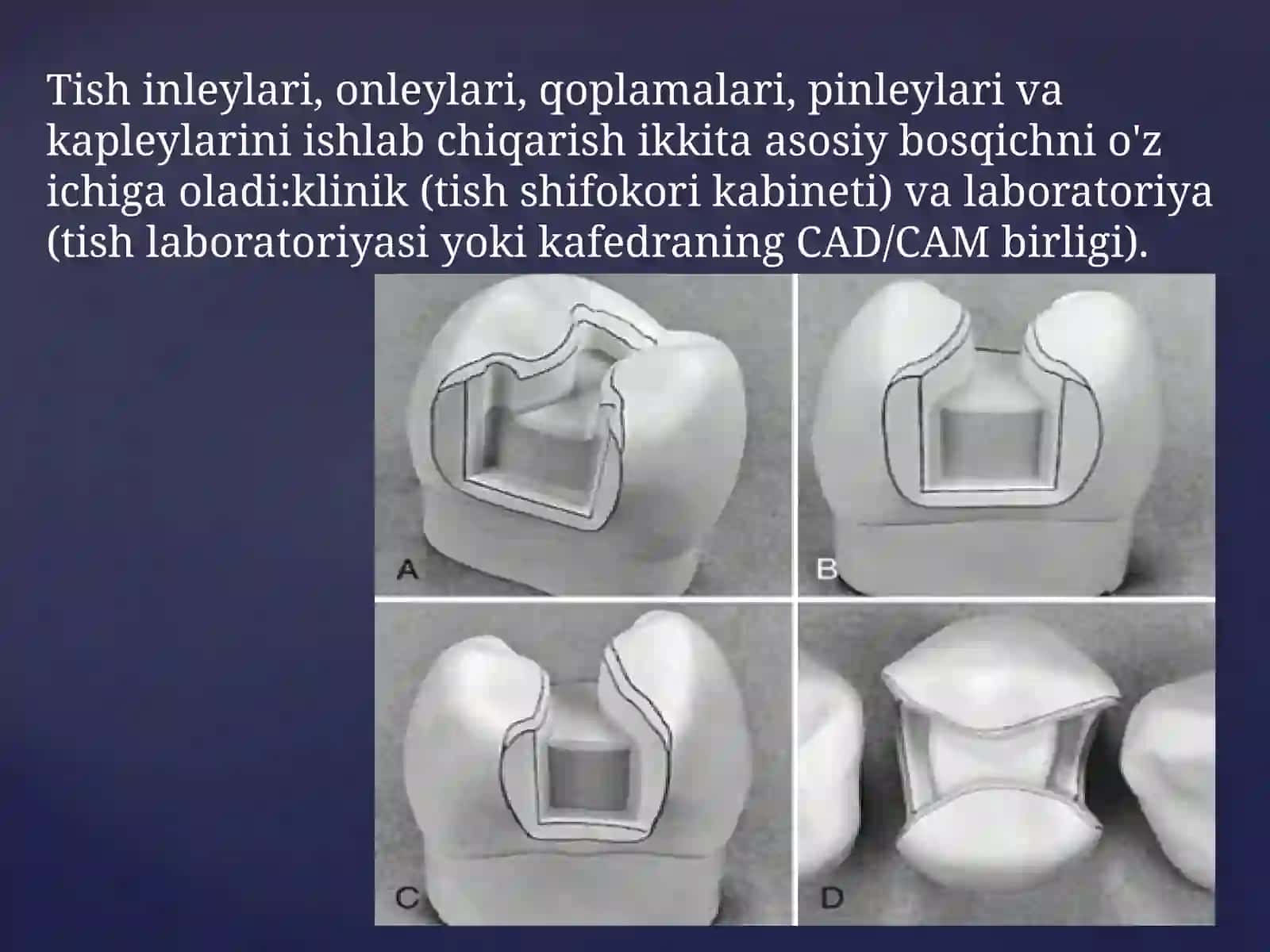 Metallqistirmalarni ishlab chiqarishning klinik va laborator bosqichlari 2
