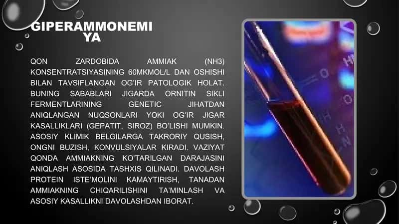 Giperammonemiya turlari, tashxis va davolash 2