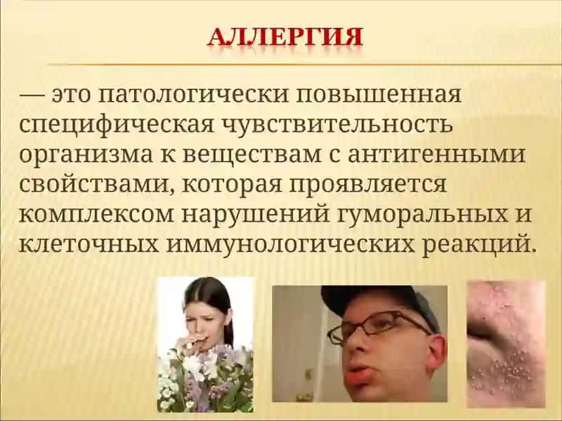 Allergiya 2