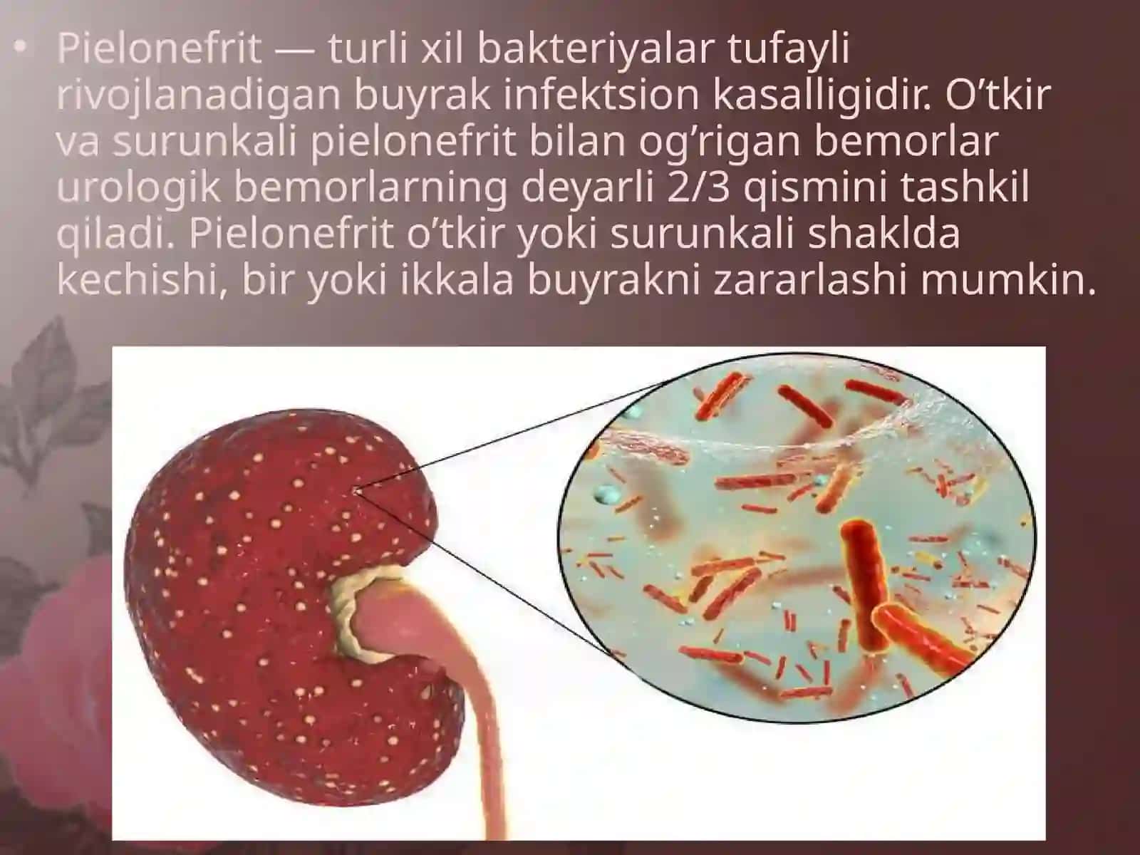 O`tkir va surunkali piyelonefrit. Simptomlari, asoratlari va davolash yo`llari 2