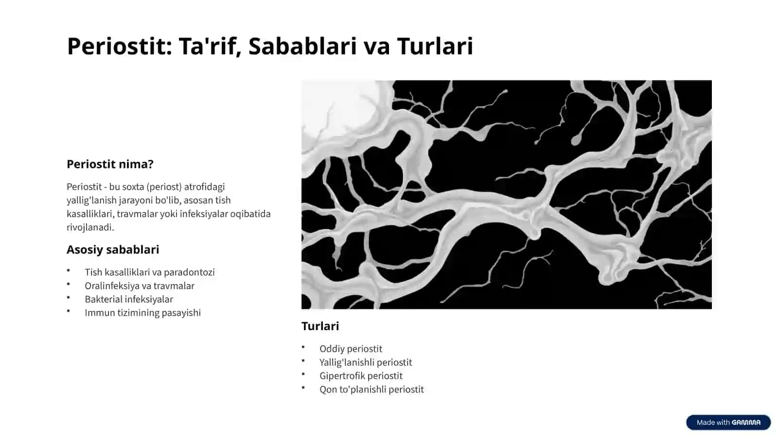 Periostit 2