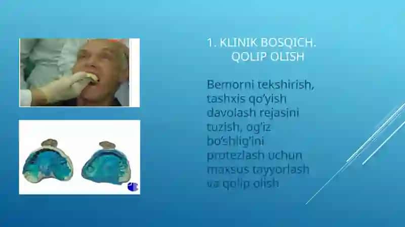 Byugel protezini tayyorlashning klinik-laborator bosqichlari 2