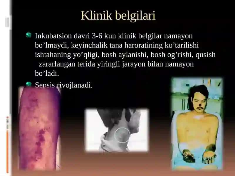 YUqumlivayuqumsizkasalliklar 2