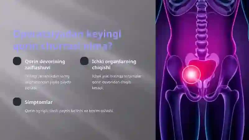 Operatsiyadan keyingi qorin churralari sabablari 2