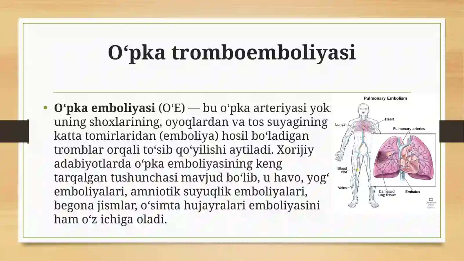 O‘pkaarteriyasitromboemboliyasi 2