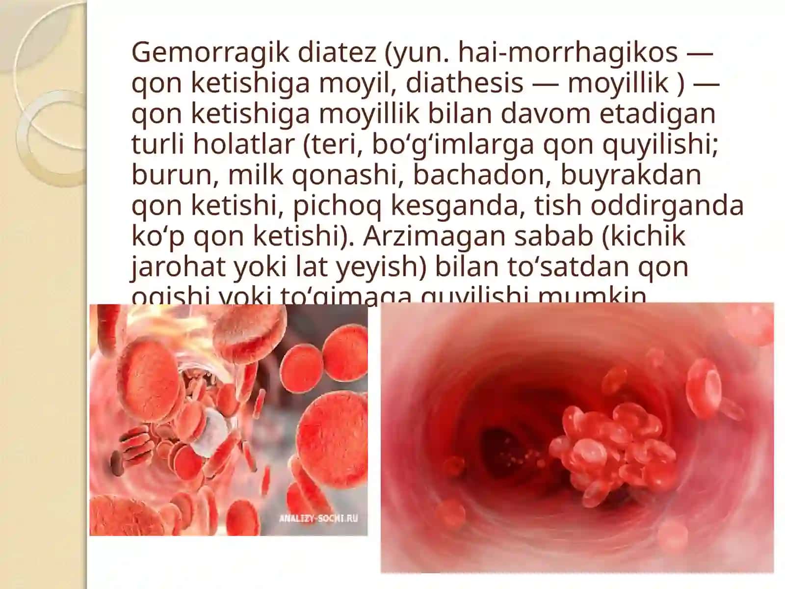 Gemorragik diatezlarning ko’rinishlari 2