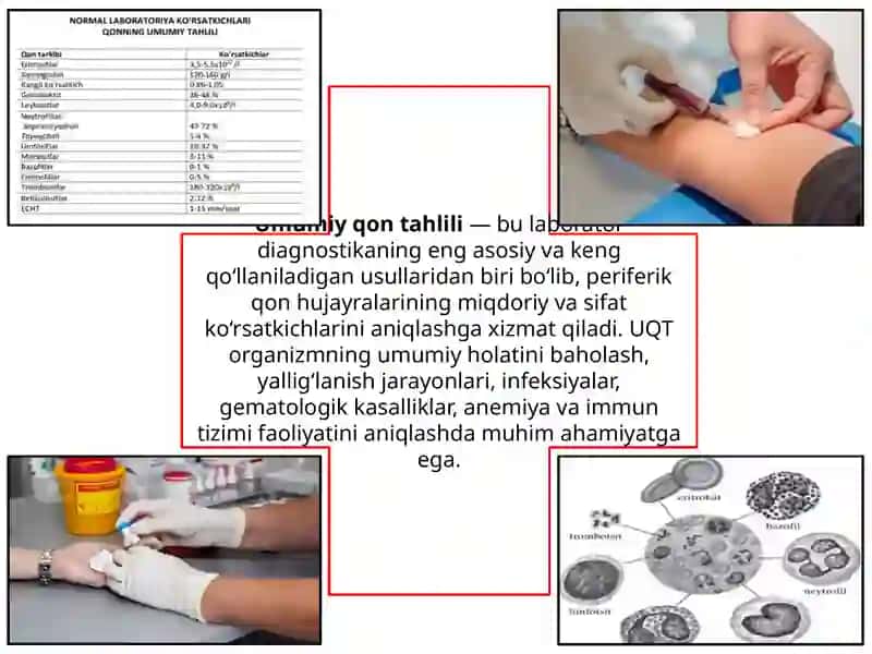 Umumiy qon va bioximik tahlil, koagulogramma 2