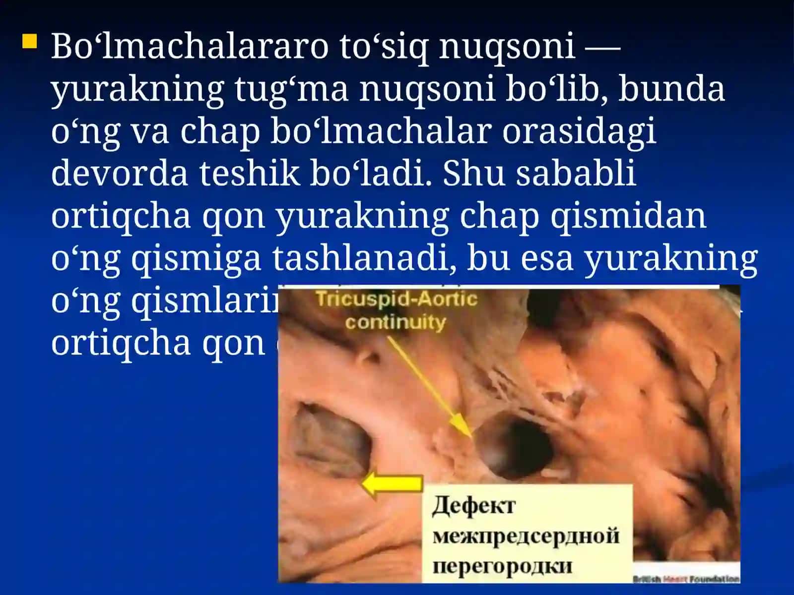 Tugma yurak kasalliklari (Fallo tetradasi, asosiy stvol transpozitsiyasi) 2